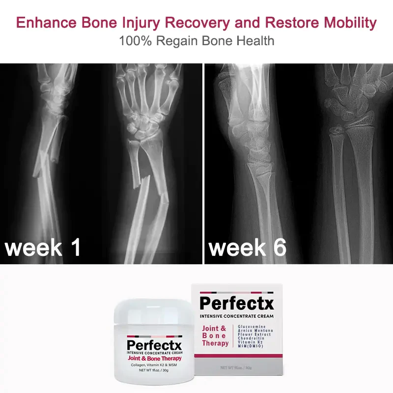 Unpree FlexiCure Joint & Bone Therapy Cream