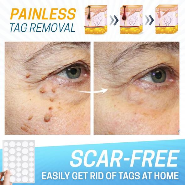 Skin Tag Pain-Free Remover Patch