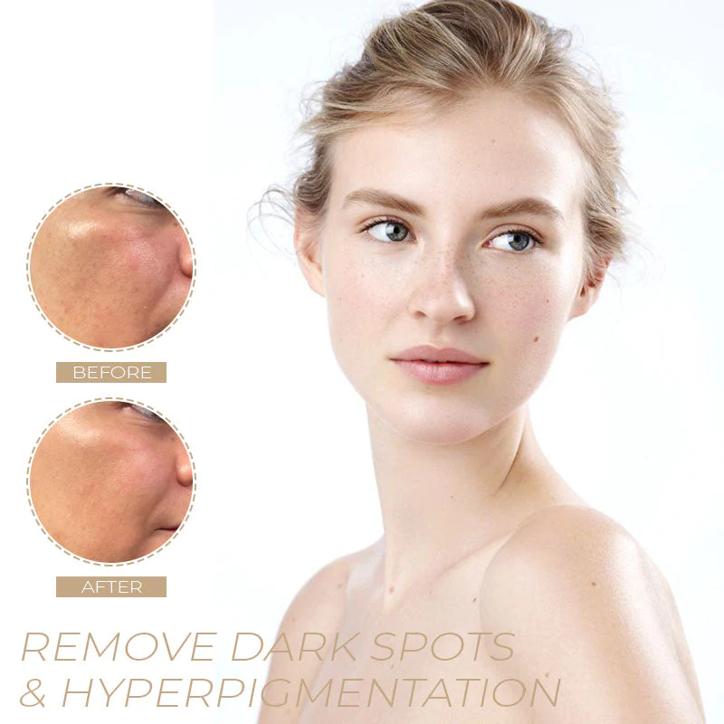 POP-Youth Spot-OFF DarkSpot Removal Serum