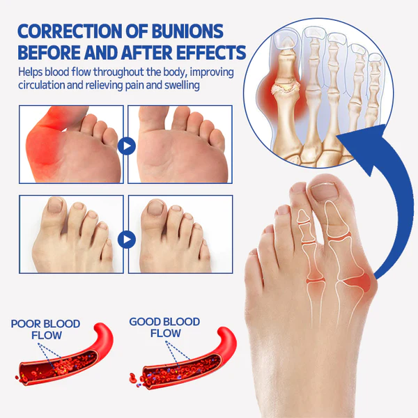 Ourlyard Bunion Pain Relief Patch