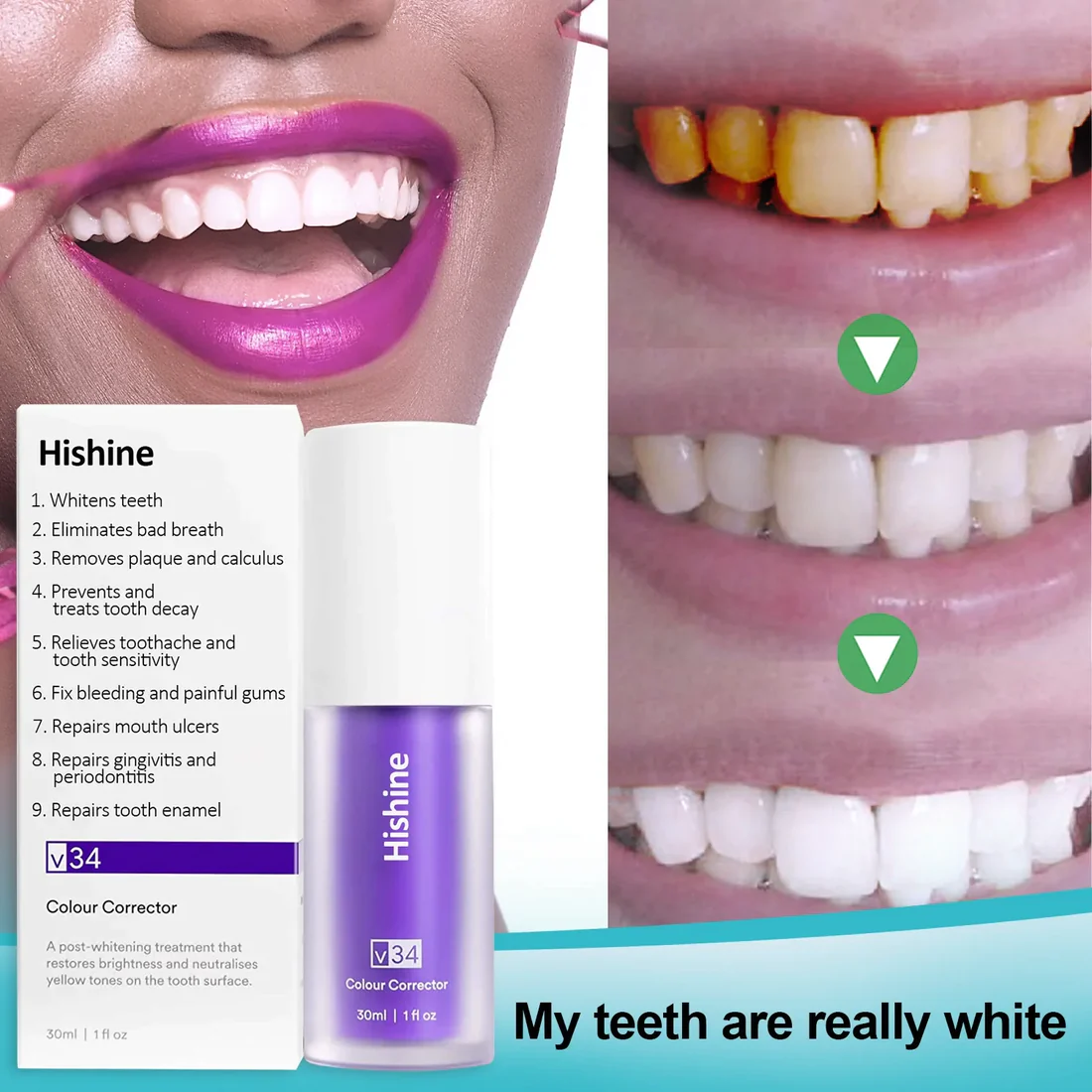 Oveallgo Pure Herbal Teeth Whitening Mousse