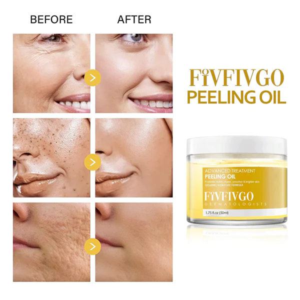 Fivfivgo 30 Days Anti-Wrinkle Exfoliate Peeling Oil