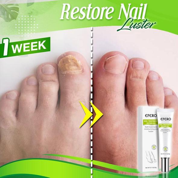 Toe Regeneration Beauty Gel