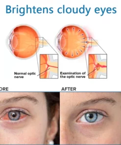 Ourlyard Eye drops for treating vision issues