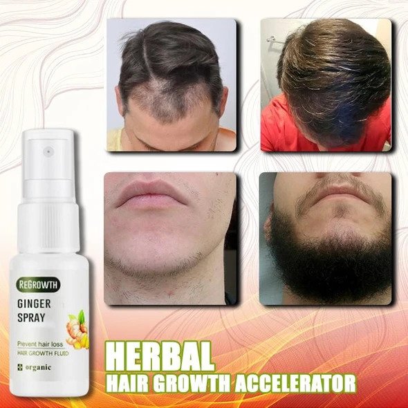 GingerGrowth Anti-Hair Loss Spray