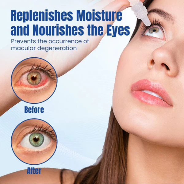 Ceoerty OptiRenew Eye Treatment Drops