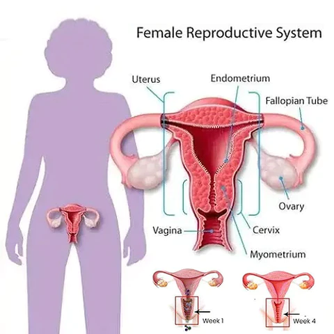 IONShaper Graphene Honeycomb Vaginal Firming and Shaping Briefs