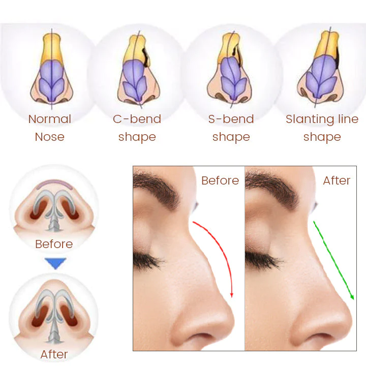 Ceoerty NoseTique Rhinoplasty Serum