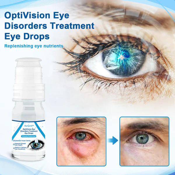 Ourlyard OptiVision Eye Disorders Treatment Eye Drops