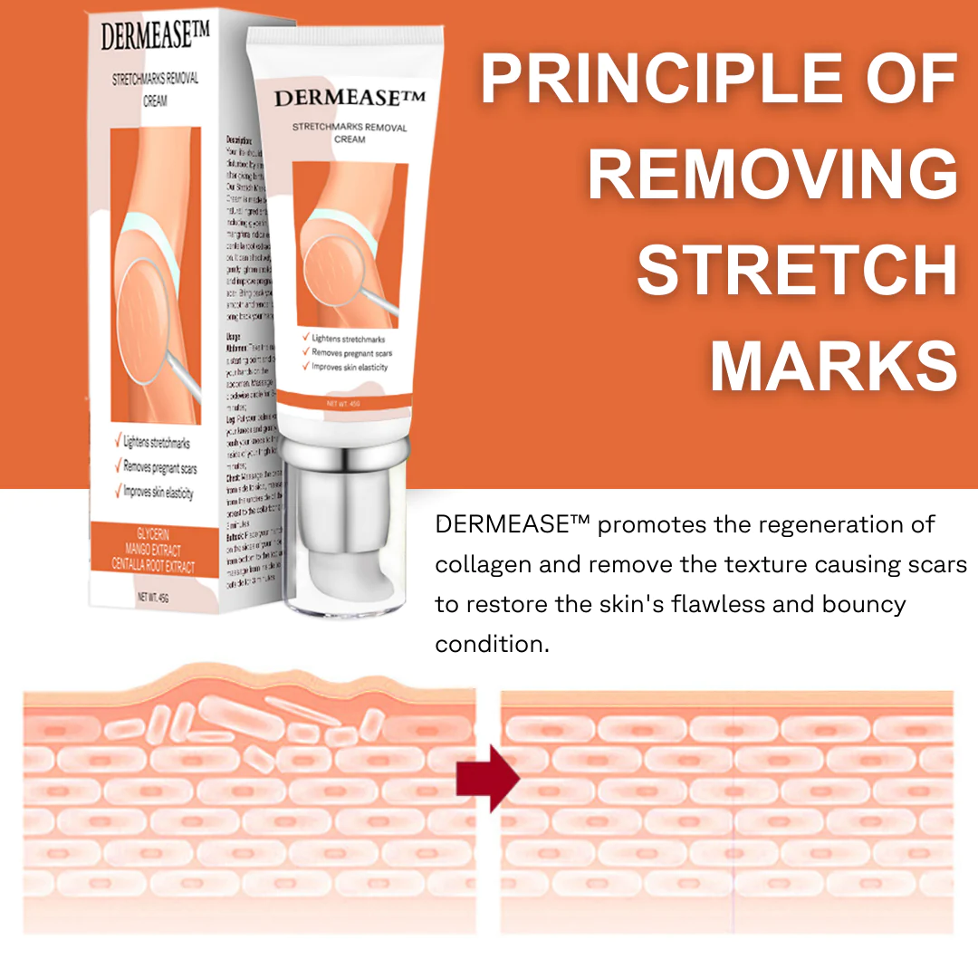 DERMEASE Stretchmarks Removal Cream