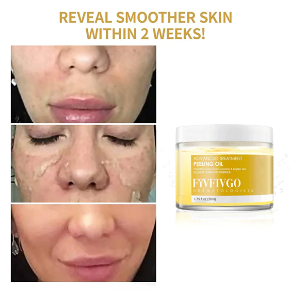 Fivfivgo 30 Days Anti-Wrinkle Exfoliate Peeling Oil