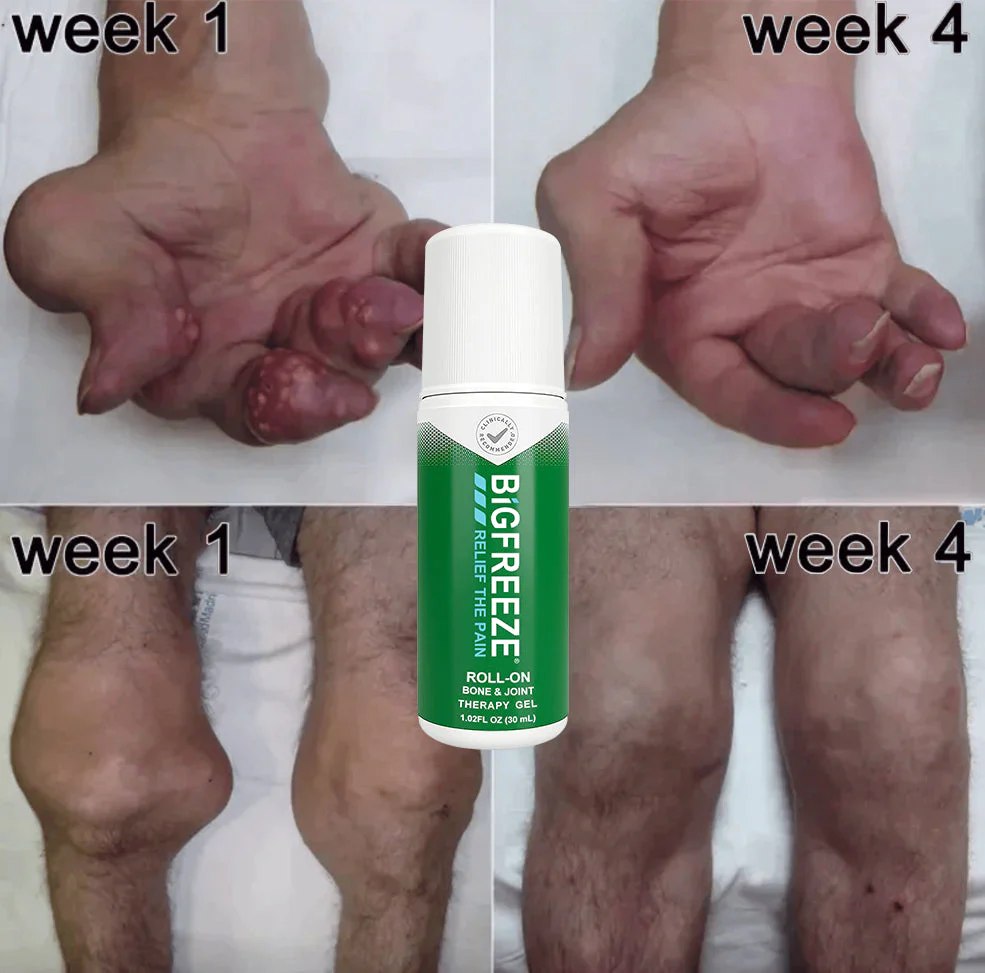 Bigfreeze Joint & Bone Therapy Roll-On Gel