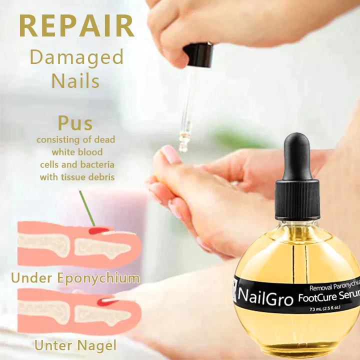 NailGro FootCure Removal Paronychia Serum