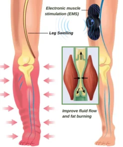 SlimTech LymphDrainage Leg Massager