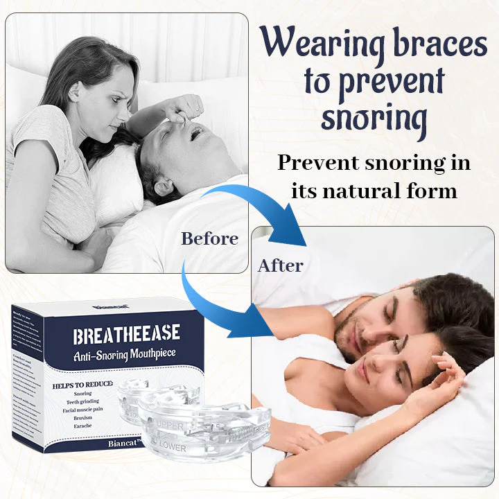 Suptruck BreatheEase Anti-Snoring Mouthpiece