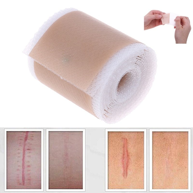 Efficient Surgery Scar Removal Silicone Gel