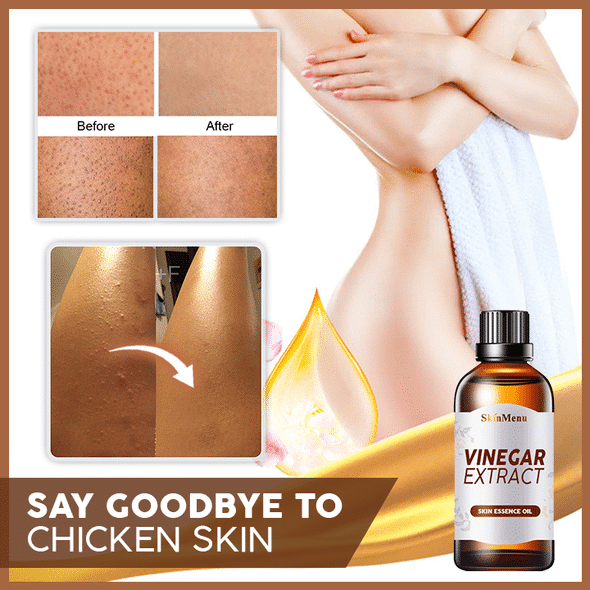 Vinegar Extract Skin Tightener