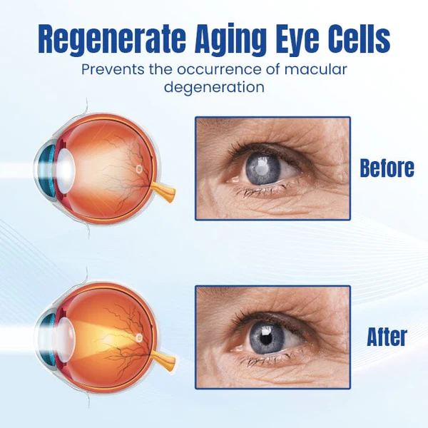 Ceoerty OptiRenew Eye Treatment Drops