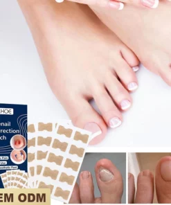 Toenail Corrector Patch (30 Pack)