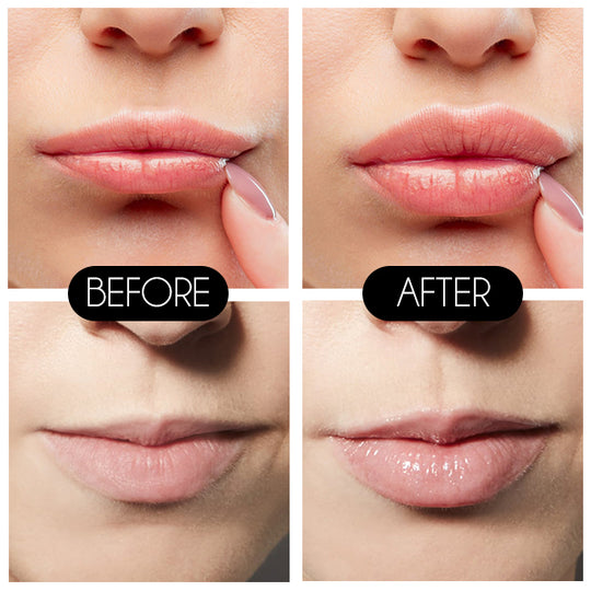 Natural Lip Plumper