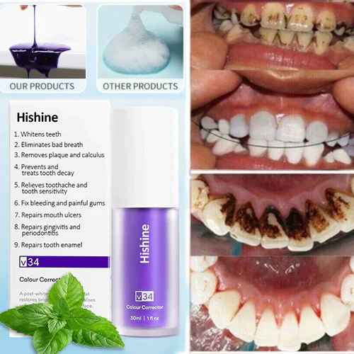 Oveallgo Pure Herbal Teeth Whitening Mousse