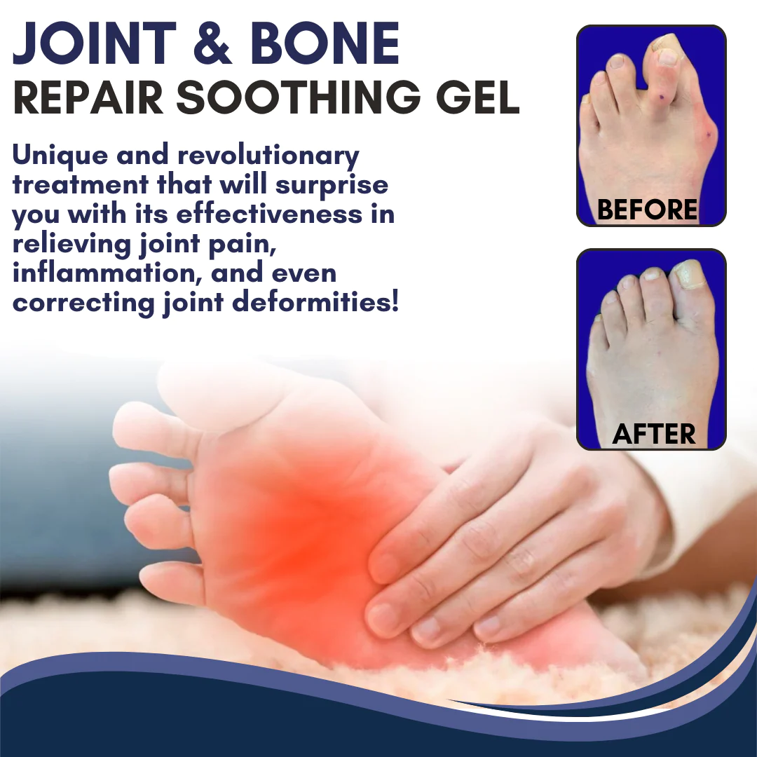 Oveallgo Joint & Bone Repair Gel Roller