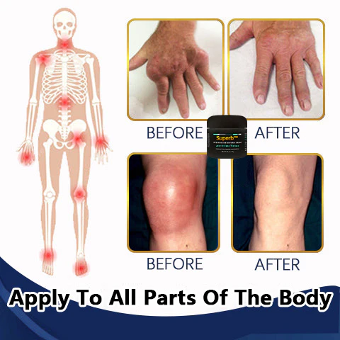 Superb Bone Regeneration Cream