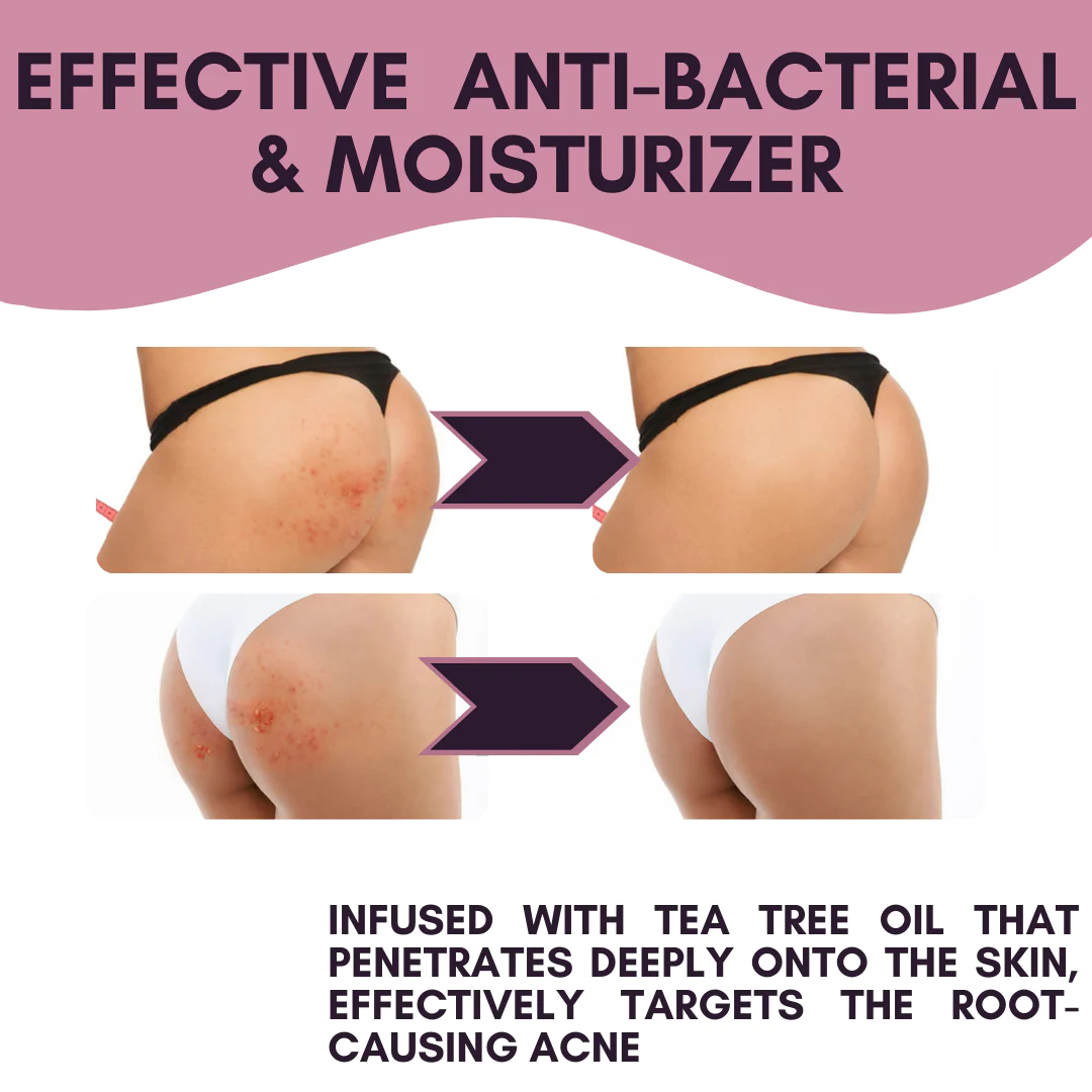 Bootieful Butt Treatment Cream