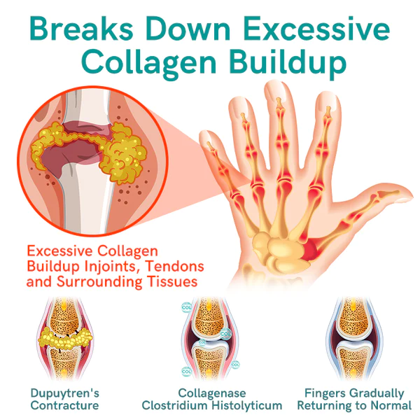 GFOUK Collagenase and Bone Therapy Cream