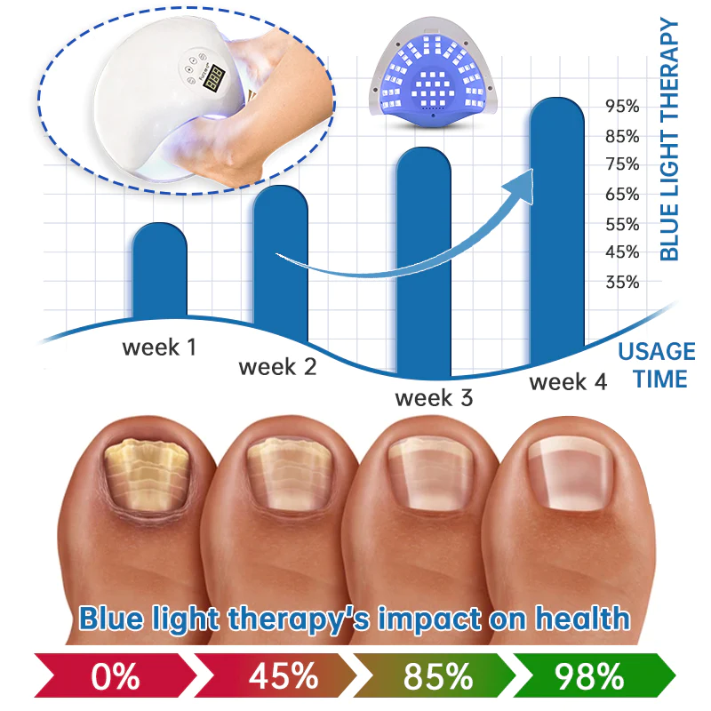 Furzero Highly Effective Onychomycosis Machine laser device