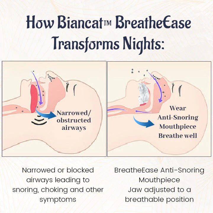 Suptruck BreatheEase Anti-Snoring Mouthpiece