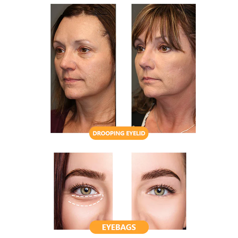 Wrinleaway Growth Factor Firming Eye Oil