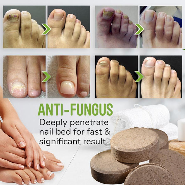 AntiFungal Foot Soak