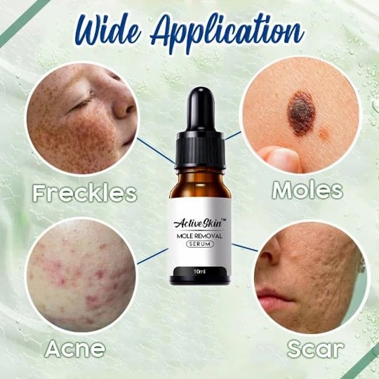 ActiveSkin Mole Removal Serum