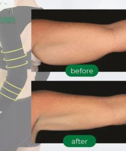 Arm Shaping Sleeves With Posture Support