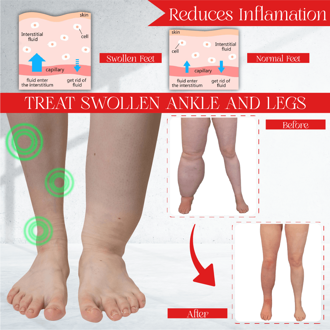 AntiSwell Organic Ginger FootPatch