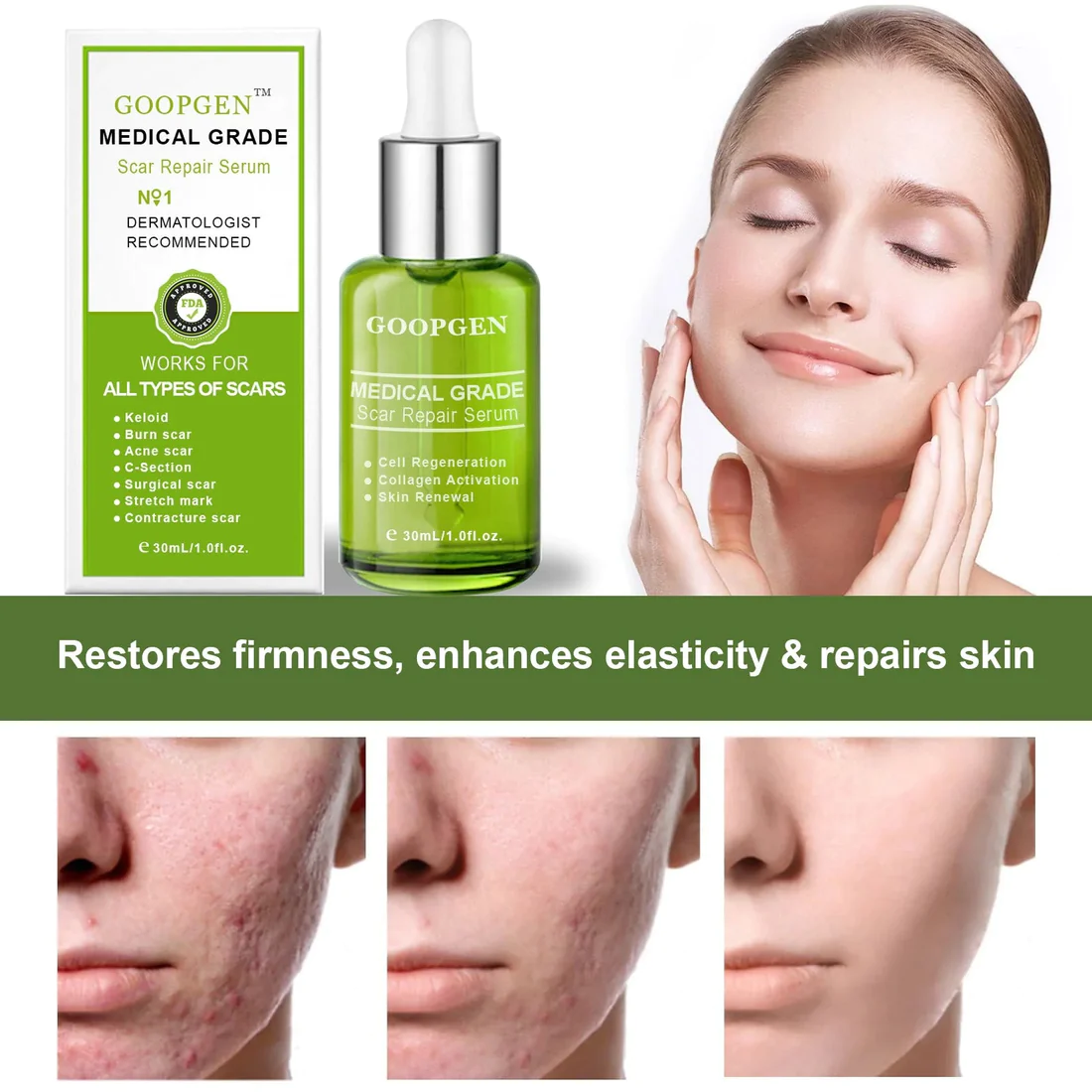 GOOPGEN Advanced Scar Repair Serum For All Types of Scars  Especially Acne Scars, Surgical Scars and Stretch Marks