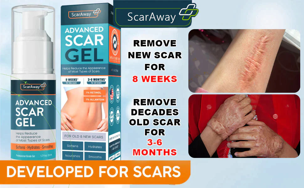 Oveallgo ScarAway Professional Advanced Scar Gel  C-Section, Tummy Tuck, Old Scars, Keloids, Stretch Marks, Burn Scars