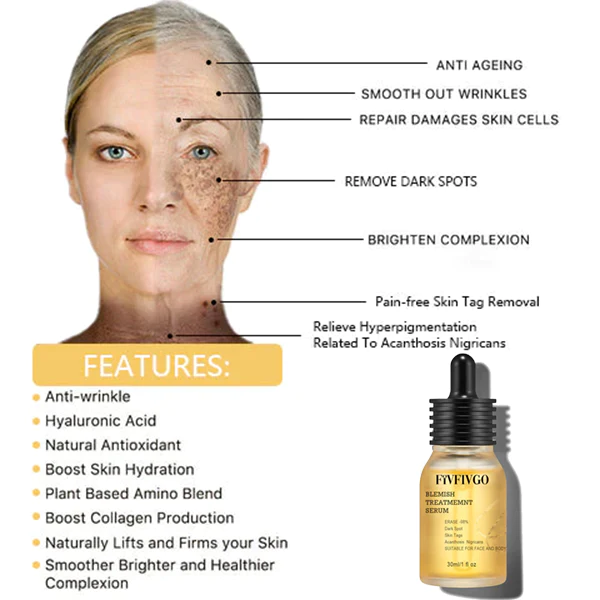 TLOPA Blemish Treatment serum for Dark Spots & Acanthosis Nigricans & Skin Tag