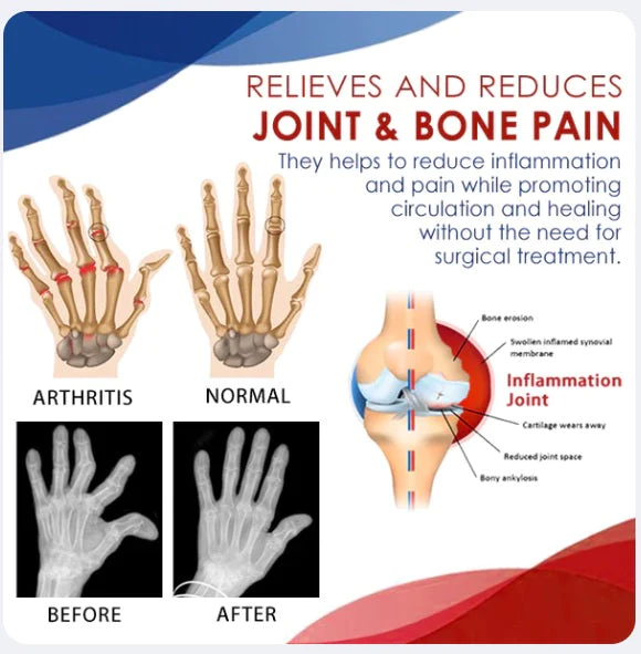 2023 TherapyX Joint and Bone Therapy Gel