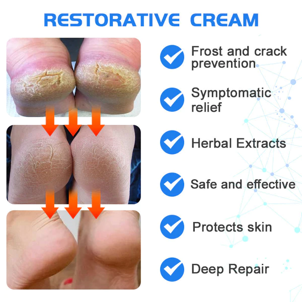 Furzero Intense Cracked Heel Repair Cream