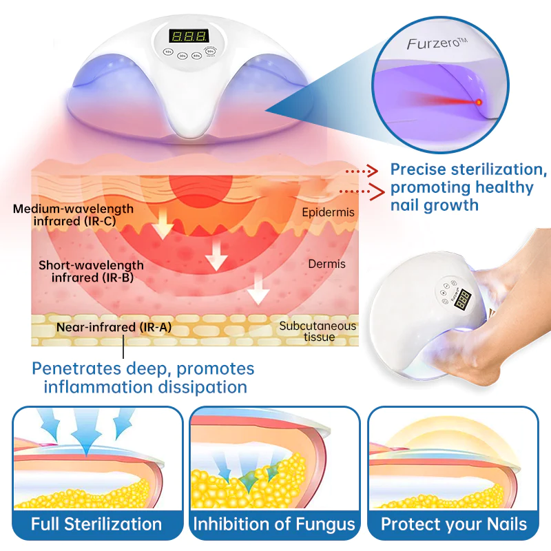 Furzero Highly Effective Onychomycosis Machine laser device