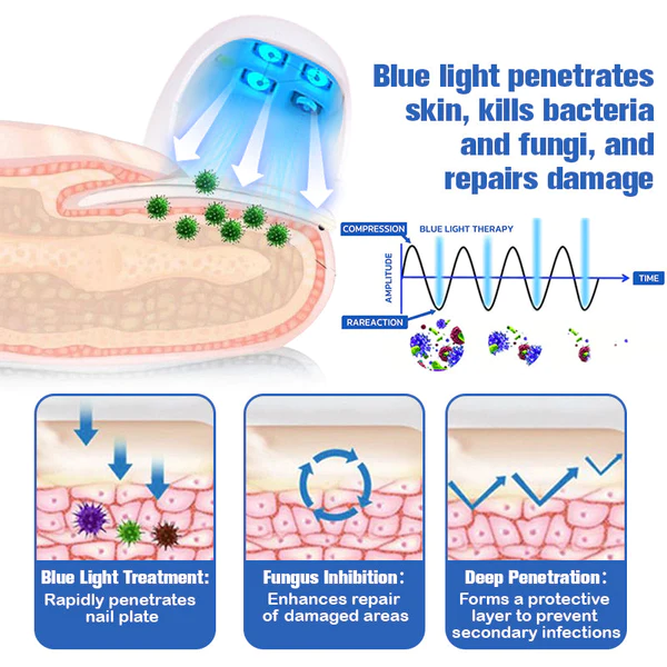 Furzero Nail Fungus Cleaning Laser Relief Device