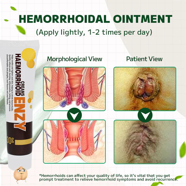 Lotmay Maximum Strength Hemorrhoids and Fissure Ointment