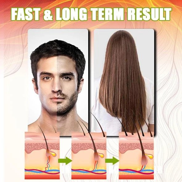 GingerGrowth Anti-Hair Loss Spray