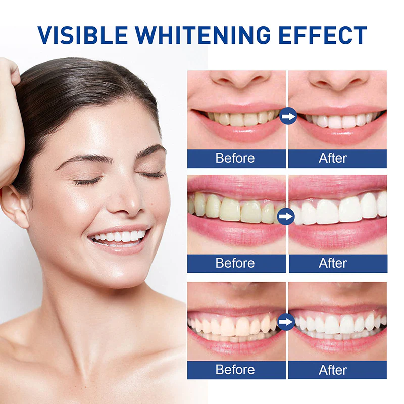 Tohcare Instant Teeth-Whitening Pen