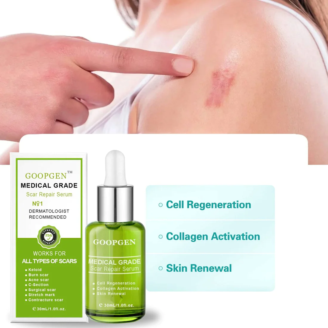 GOOPGEN Advanced Scar Repair Serum For All Types of Scars  Especially Acne Scars, Surgical Scars and Stretch Marks