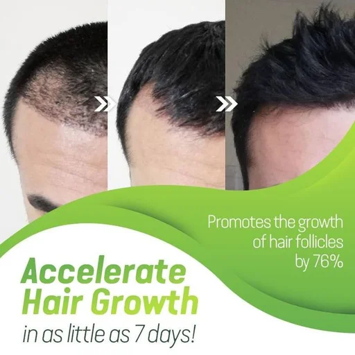 Ceoerty GingerEssence Hair Growth Serum