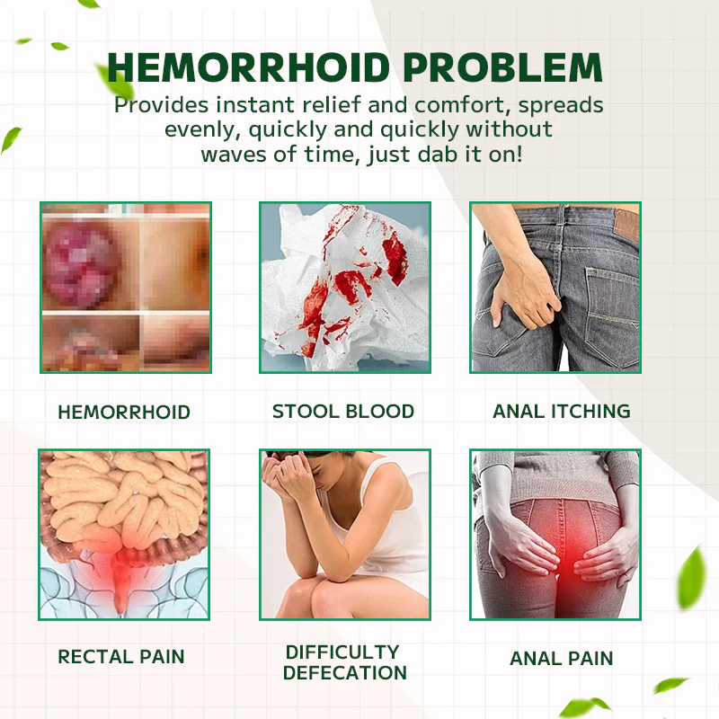 Ourlyard Hemorrhoidal Ointment