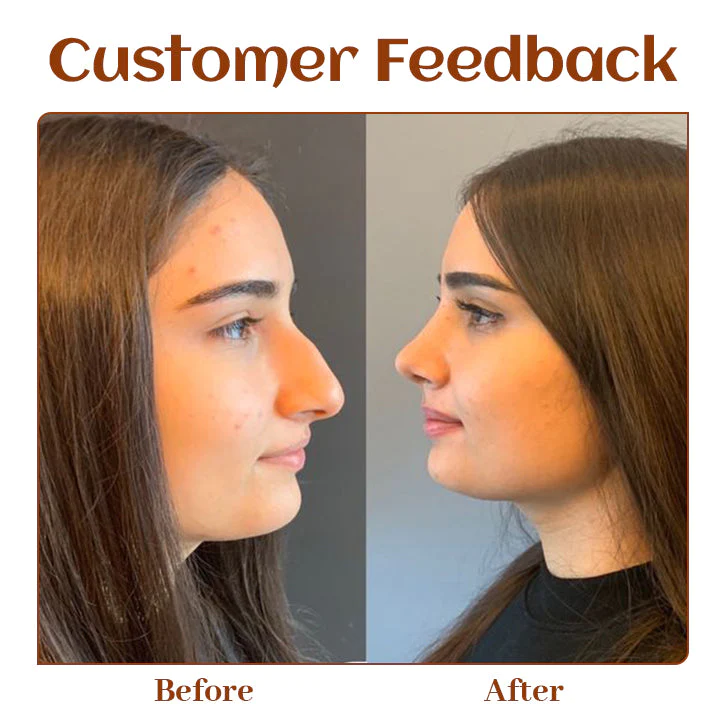 Ceoerty NoseTique Rhinoplasty Serum